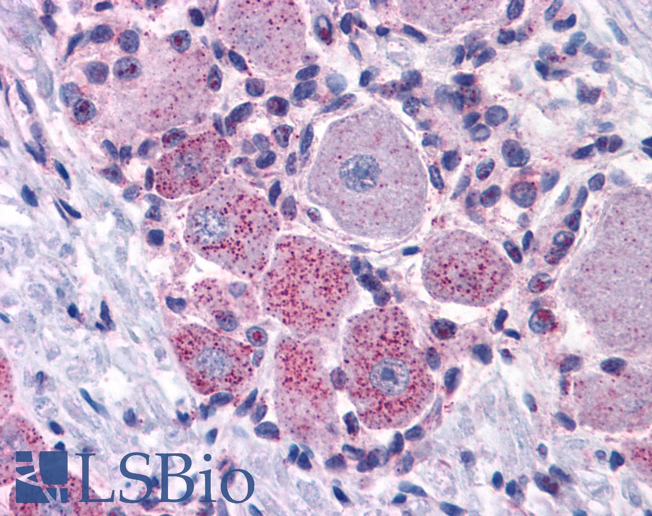 PathPlus™ MRGPRX2 / MRGX2 Antibody (Extracellular Domain)