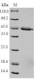 Human TIMM17A / TIM17 Protein (Recombinant GST, N-terminus)