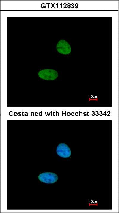 Polyclonal Rabbit anti-Human PARP1 Antibody (IF, WB)