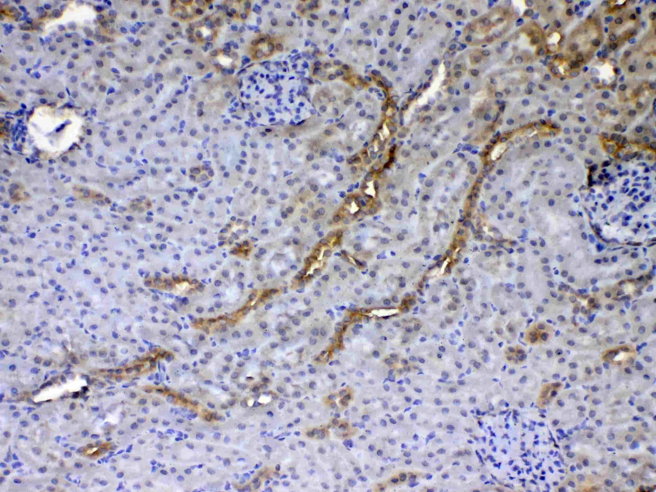 GALE / UDP-Glucose 4-Epimerase Antibody