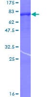 Human PPP3CC / CALNA3 Protein (Recombinant GST)