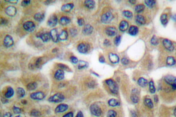 CGB / hCG Beta Antibody (Asp131)