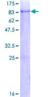 Human ALS2CR15 / ICA1L Protein (Recombinant GST)