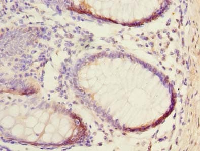 NUBPL Antibody