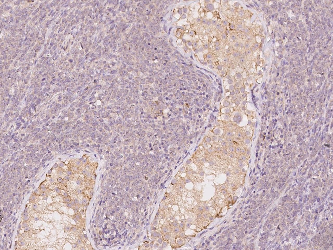 LRRC56 Antibody