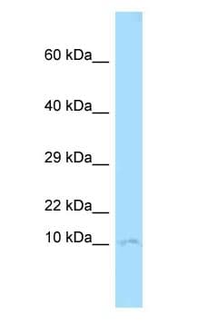 CKS1B / CKS1 Antibody (aa16-65)