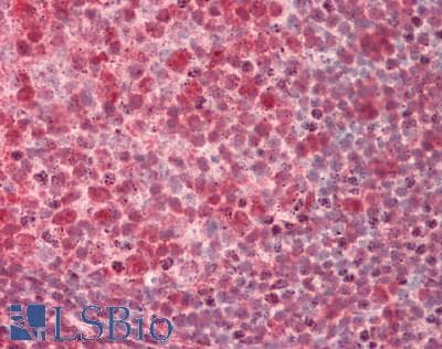 IHC-plus™ MED1 / TRAP220 Antibody (aa1525-C-term)