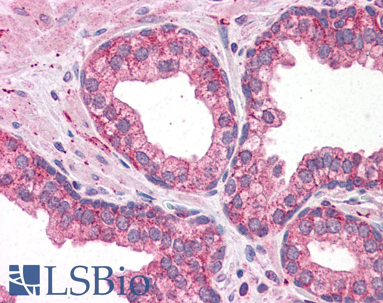 PathPlus™ PDGFRA / PDGFR Alpha Antibody