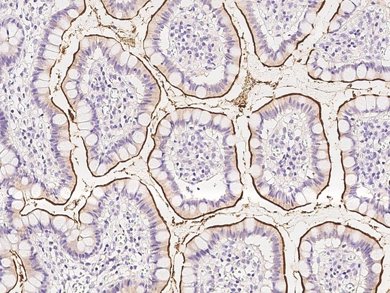 Polyclonal Rabbit anti-Human ENPEP / Aminopeptidase A Antibody (IHC, IF)