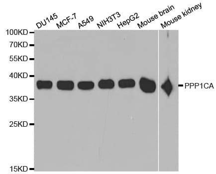 IHC-plus™ PPP1CA / PP1-Alpha Antibody