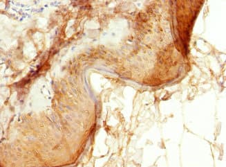 Polyclonal Rabbit anti-Human EPS15L1 / EPS15R Antibody (IHC, WB)