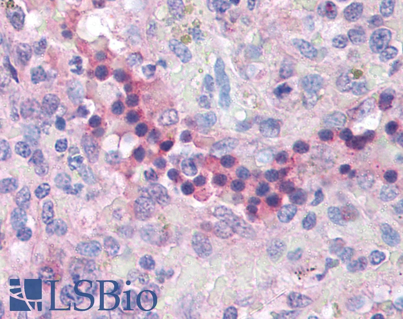 IHC-plus™ IL32 Antibody