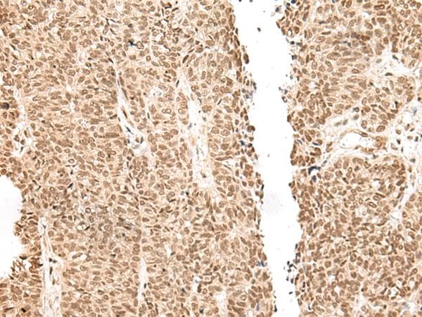 GAL4 / Galectin 4 Antibody