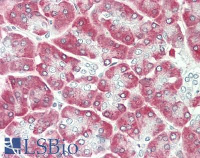 IHC-plus™ Polyclonal Rabbit anti-Human RPS6 / Ribosomal Protein S6 Antibody (aa200-C-term, IHC, WB)