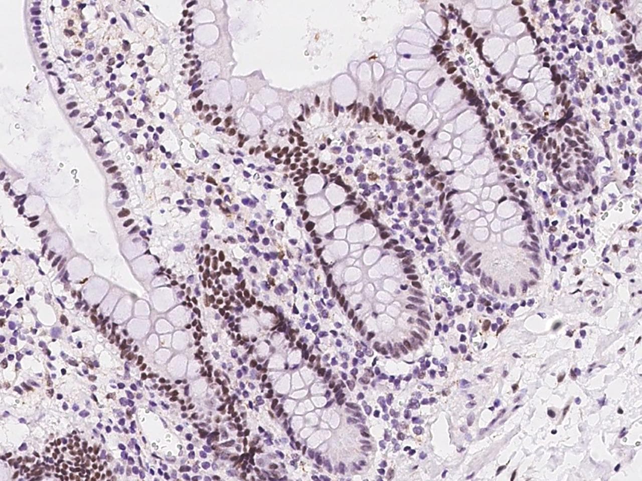 UCK1 Antibody