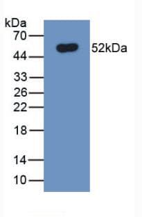 SLC40A1 / Ferroportin-1 Antibody