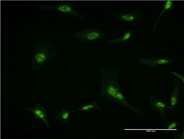 Monoclonal Mouse anti-Human RPL7 / Ribosomal Protein L7 Antibody (clone 2E10, IF)