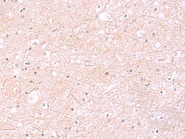 RABEPK / p40 Antibody