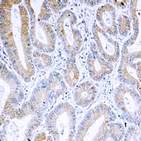 Polyclonal Rabbit anti-Human ARF4 Antibody (Internal, IHC, WB)