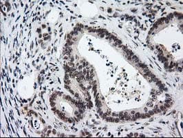 PRKCE / PKC-Epsilon Antibody (clone OTI2A12)