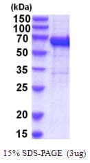 Human IL12RB1 / CD212 Protein (Recombinant His)