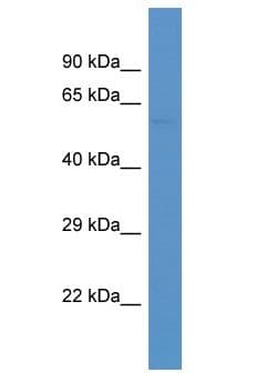 Polyclonal Rabbit anti-Mouse SMAD6 Antibody (aa398-447, WB)