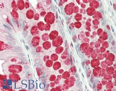 Polyclonal Rabbit anti-Human TFF3 / Trefoil Factor 3 Antibody (aa22-94, IHC, WB)