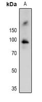 RPS6KA1 / RSK1 Antibody