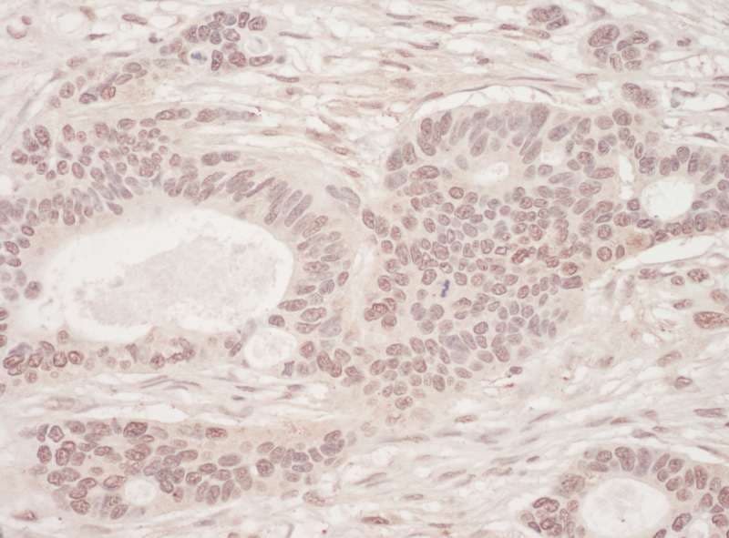 SLTM Antibody (aa800-850)
