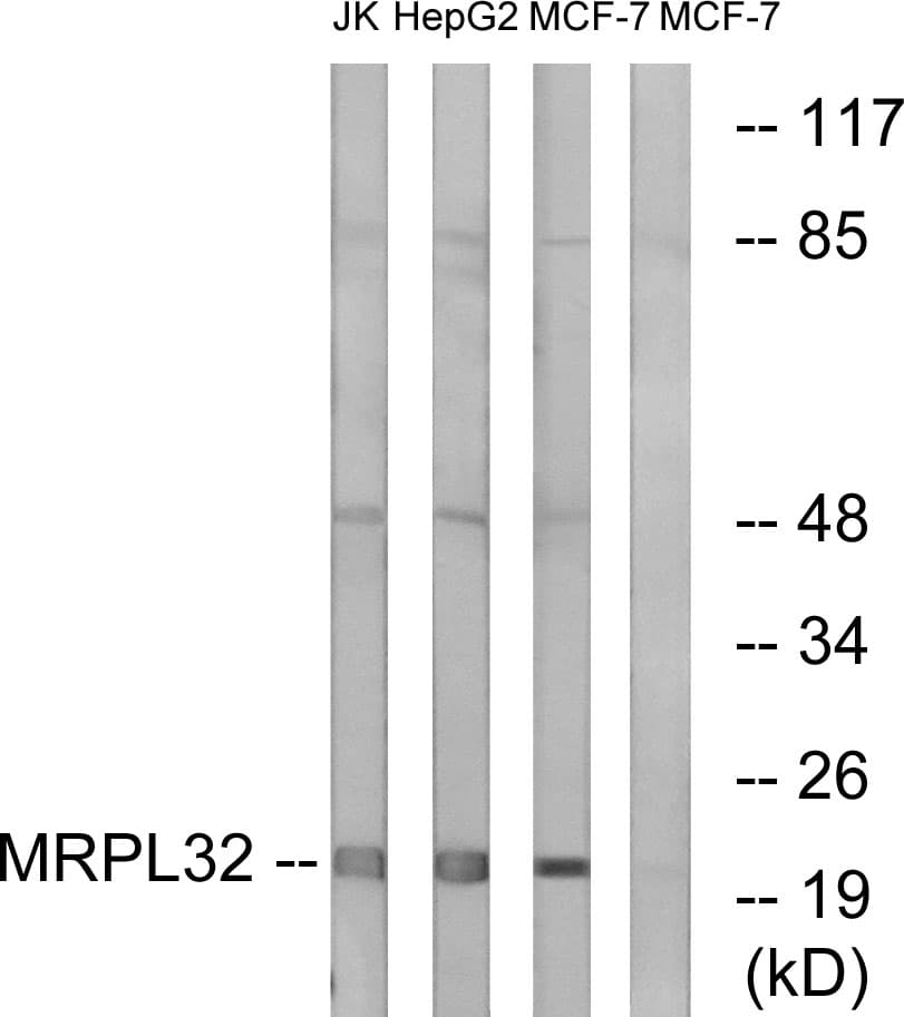 MRPL32 Antibody (aa101-150)
