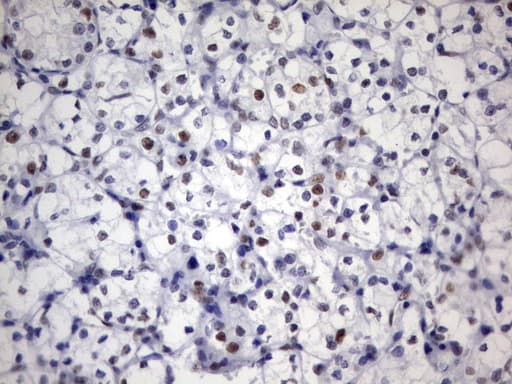 PARN Antibody (aa1-266, clone UMAB143, Carrier-free)