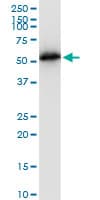 IHC-plus™ TUBB2A / Tubulin Beta 2A Antibody (clone 4C8)