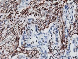 Latexin / MUM Antibody (clone OTI1E10)