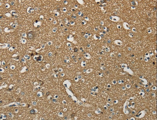 Polyclonal Rabbit anti-Human SDCCAG1 / NEMF Antibody (IHC, WB)