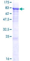 Human P4HA2 Protein (Recombinant GST)