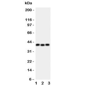 WNT5A Antibody (aa184-303)