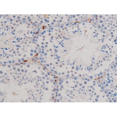 CDC25A Antibody (phospho-Ser75)