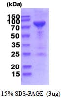 Human PNPT1 Protein (Recombinant His)