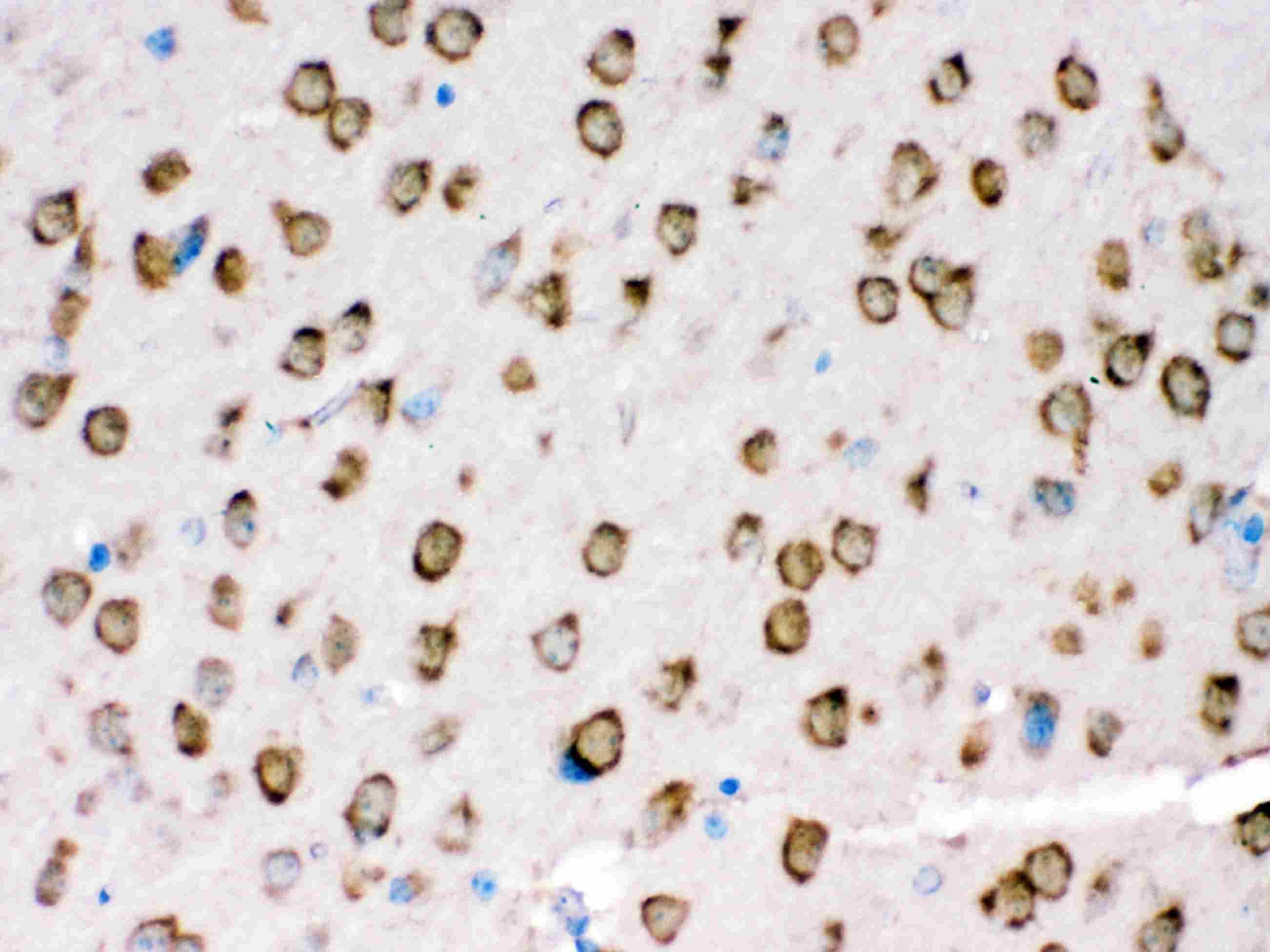 TRPM5 Antibody (aa1021-1108)