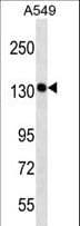 PDS5A Antibody (aa1309-1337)