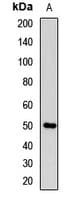 SHH / Sonic Hedgehog Antibody