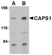 IHC-plus™ CADPS Antibody