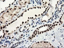 NMNAT1 / NMNAT Antibody (clone OTI1G4)