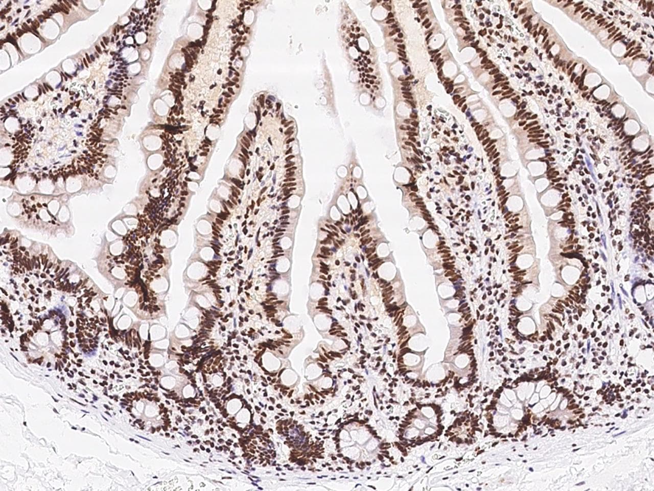 SIN3A Antibody (N-Terminus)