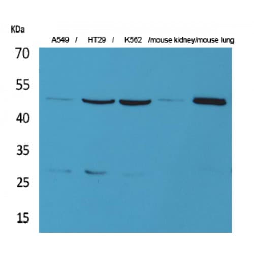 GDI2 Antibody (C-terminal)