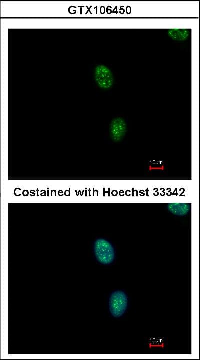 Polyclonal Rabbit anti-Human SAP130 Antibody (aa1154-1217, IHC, WB)