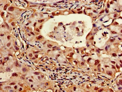 Polyclonal Rabbit anti-Human ATP5D Antibody (aa23-168)