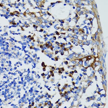 US01 / p115 Antibody