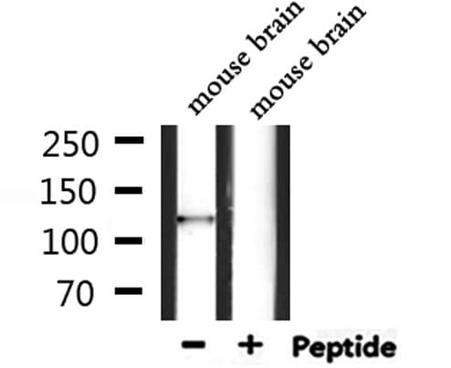 CAMTA2 Antibody