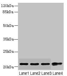 CSRP2 Antibody (aa1-193)